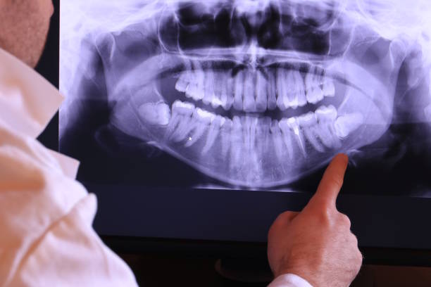 Best Emergency Tooth Extraction in Mount Vista, WA