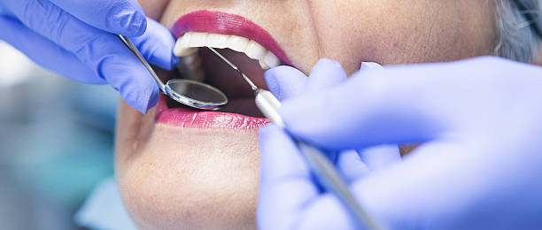Best Urgent Care for Lost Fillings or Crowns in Mount Vista, WA